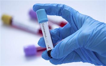 الصحة السعودية تعلن تسجيل 46 حالة اصابة بفيروس كورونا وتعافي 54 حالة