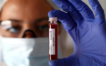 المخابرات الأمريكية : فيروس كورونا لم يتم تخليقه باعتباره سلاحا بيولوجيا
