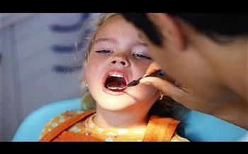 ما أسباب تسوس الأسنان عند الأطفال؟..«الصحة» تجيب