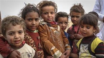 الصحة العالمية: 3 من كل 4 أطفال يمنيين يعانون سوء التغذية المزمن