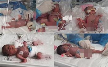 لأول مرة منذ 34 عاما.. ولادة خمسة توائم في كوريا الجنوبية