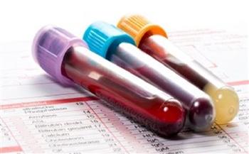 تحاليل طبية مهمة.. متى تجري تحليل عدد الصفائح الدموية؟