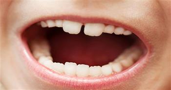 الأسنان اللبنية ظهرت مبكراً لدى الإنسان البدائي