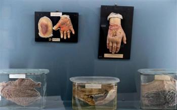 متحف للتاريخ الطبيعي يعرض الجماجم والأعضاء البشرية في «فاترينة»