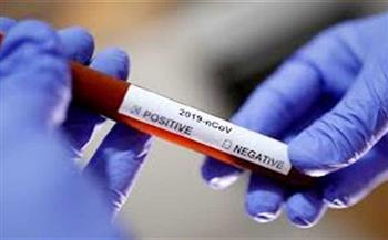 العراق يسجل 172 إصابة جديدة بفيروس كورونا المستجد 