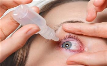10 نصائح للتغلب على جفاف العين.. تعرف عليها