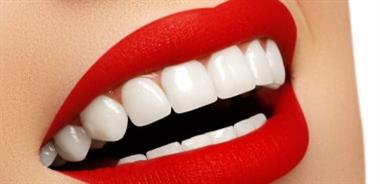 4 علاجات منزلية لتبييض الأسنان أثناء فترة كورونا  