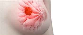 أبرزها «الورم الليفى».. تعرف على أشهر أمراض الثدى عند النساء