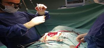 إنقاذ طفلة 6 سنوات بجراحة ناجحة بمستشفى المنصورة الدولي