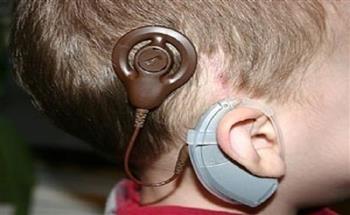 ما هي فوائد زراعة القوقعة السمعية والمضاعفات الناتجة عنها؟