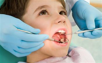 تعرف على أسباب ومراحل تسوس أسنان الأطفال وطرق الوقاية