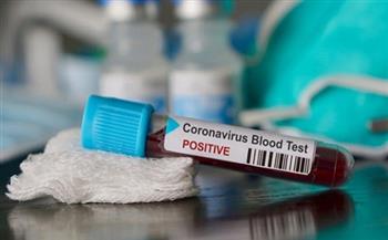 بلغاريا تسجل 105 إصابات جديدة بفيروس كورونا