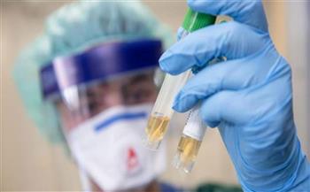 لبنان يسجل 104 إصابات جديدة بفيروس كورونا و4 حالات وفاة