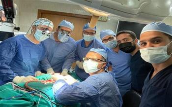 جزء منه فى قاع الجمجمة.. نجاح استئصال ورم نادر لمريضة بمستشفى جامعة طنطا