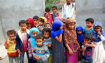 الجوع يقتل أطفال اليمن وهيئة بريطانية تُحذّر