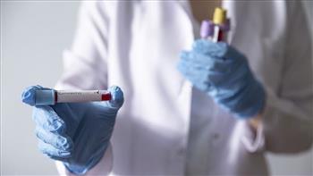 الصحة: تسجيل 51 إصابة جديدة بفيروس كورونا.. و 7 حالات وفاة