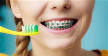 نصائح لتفادي مشكلة تركيب تقويم الأسنان للأطفال.. تجنب هذه العادات الخاطئة