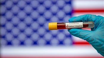 الولايات المتحدة تسجل 17230 إصابات و217 وفاة بكورونا