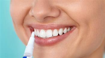 تبييض الأسنان.. ما هي أنواعه ولماذا يجب تجنب استخدام المعجون المبيض؟ 