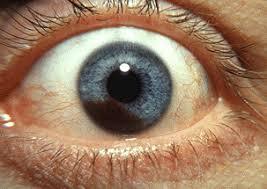 علاج مناعي جديد لأكثر أشكال سرطان العين شيوعًا 