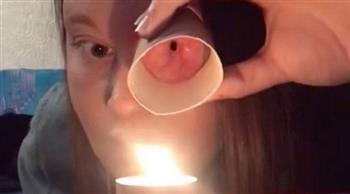 بعد إزالتها بسبب السرطان.. بريطانية تبهر الجميع بقدرتها على إطفاء الشموع بعينيها (صور)