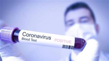 تسجّيل 265 إصابة جديدة بفيروس كورونا المستجد في الإمارات