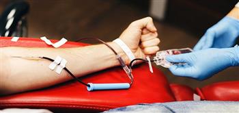  هل يمكن لمريض الصدفية التبرع بالدم؟