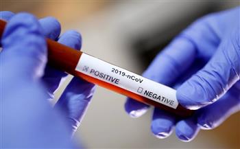 الجزائر تسجل 341 إصابة جديدة بفيروس كورونا