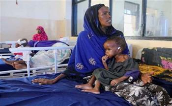 سوء التغذية يهدد حياة أكثر من نصف مليون طفل في مناطق وسط الصومال