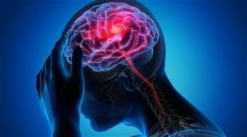 انسداد الشرايين السباتي يؤدي للسكتة الدماغية