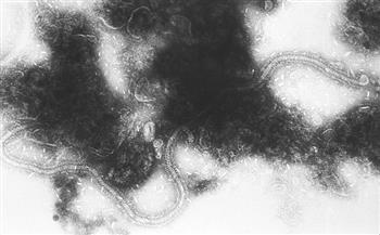 خبير صحة أمريكي: تفاقم عدوى الفيروس المخلوي التنفسي في ظل ضعف مناعة الأطفال بفعل "كورونا"