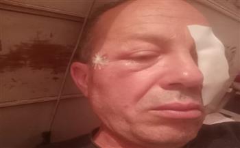 إصابة قائد قطار «شربين - طنطا» بعد قذفه بالحجارة