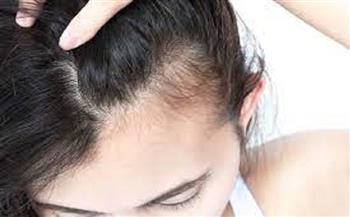 5 وصفات طبيعية تجنبك زراعة الشعر
