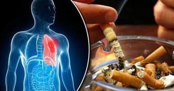 95% من أسباب سرطان الرئة هو التدخين
