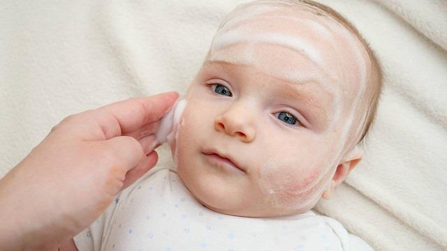 تعرفي على أهم طرق العناية بجفاف جلد أطفالك في الشتاء