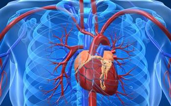 20 مليون حالة وفاة سنويا تسببها أمراض القلب والأوعية الدموية والكلي والسكر
