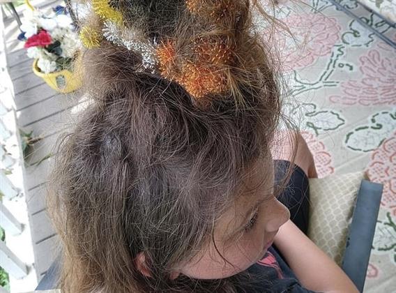 فتاة تعاني من صدمة نفسية بسبب تشابك شعرها.. اعرف القصة 