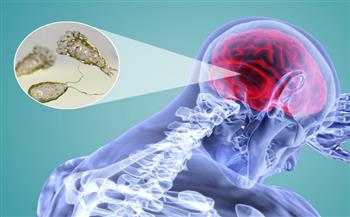 كوريا الجنوبية تؤكد أول حالة إصابة بـ "الأميبا آكلة الدماغ" في رجل خمسيني