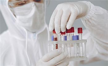 أستراليا تسجل 22 ألفا و409 إصابات جديدة بفيروس كورونا المستجد