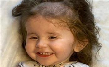 متلازمة زهرة الربيع.. طفلة تأكل خصلات شعرها بسبب حالة وراثية نادرة