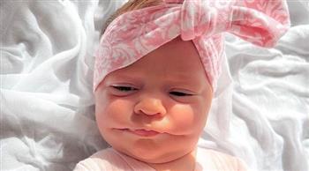 على طريقة «الجوكر».. طفلة تولد بابتسامة دائمة بسبب حالة نادرة (صور)