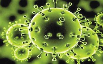 سلوفاكيا تسجل 86 إصابة جديدة بفيروس كورونا المستجد