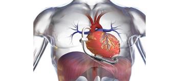 تقنية جديدة لكشف مدى تقبل الجسم لعملية زرع القلب