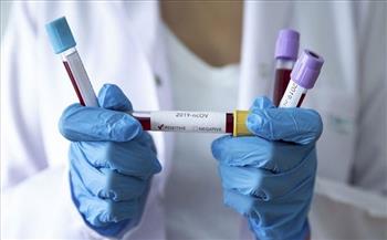 النمسا تسجل 10 آلاف و345 إصابة جديدة بفيروس كورونا