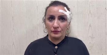 هوس عمليات التجميل ..القبض على سيدة روسية لبيعها رضيعها لتعديل أنفها 