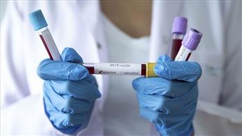 نيوزيلندا تسجل 10 آلاف و716 حالة إصابة جديدة بفيروس كورونا