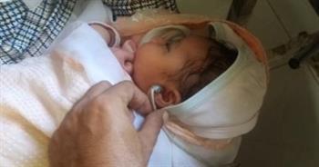 صحة المنيا: فحص وعلاج 343 ألفا و616 طفلا حديث الولادة بالمحافظة