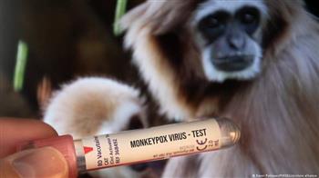الصحة العالمية تعلن تسجيل أكثر من 18 ألف إصابة بجدري القردة حول العالم