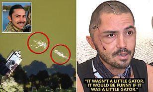 رجل ينجو من موت محقق على يد تمساح ويعيش بنصف جمجمة (فيديو)