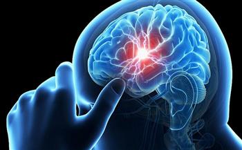 استشاري مخ وأعصاب يقدم روشتة بأفضل الأطعمة لتنشيط الذاكرة